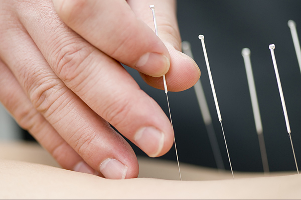 Traditional Chinese Medicine