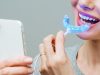 What are the key differences between professional and at-home teeth whitening?
