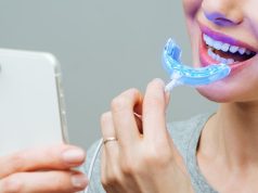 What are the key differences between professional and at-home teeth whitening?