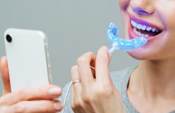 What are the key differences between professional and at-home teeth whitening?