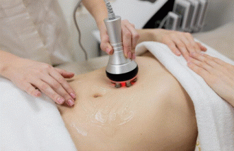 How Diet Affects Emsculpt Neo Maintenance: What Helps Results Hold Longer