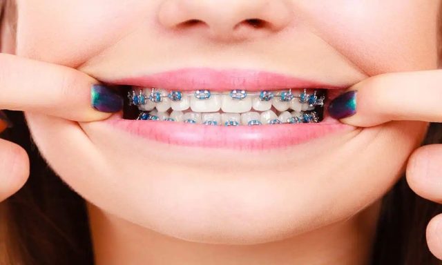 when_is_two-phase_orthodontics_recommended_12073_featured