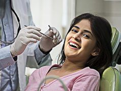 What Is Full Mouth Restoration? A Step-by-Step Guide