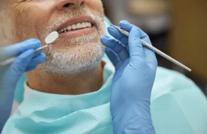 Do lifestyle habits affect the lifespan of dental veneers?
