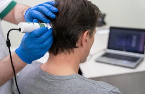 4 Signs It’s Time to Visit a Scalp Treatment Centre Instead of Changing Hair Products