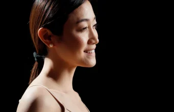 How Cheek Fillers and Forehead Fillers Improve Facial Harmony