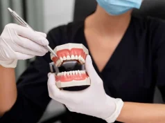 Full Mouth Dental Implants: Everything You Need to Know