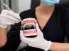 Full Mouth Dental Implants: Everything You Need to Know
